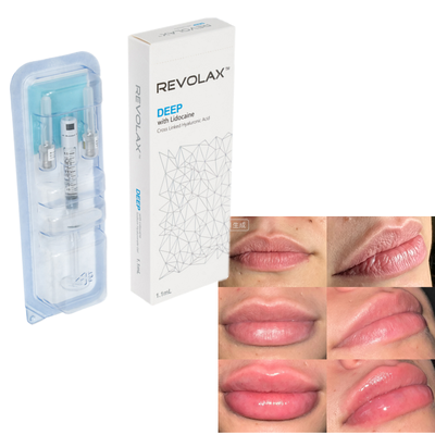 Revolax Ácido Hialurónico Preenchimento Dermológico Plump Natural Aumento do Lábio Restauração do Volume Facial
