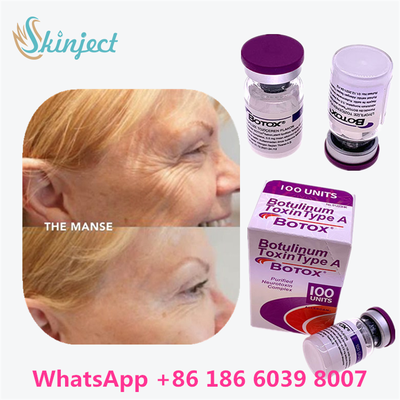 Toxina Botulínica BOTOX Cosmético 100 Unidades Alergênico OnabotulinumtoxinA para rugas faciais