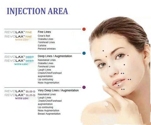 Enchimentos faciais ácidos hialurónicos de Revolax para a ampliação facial