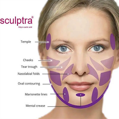 O pó de  PLLA do CE para estimula o colagênio