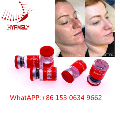Injeção meso antienvelhecimento do soro com Hyaluron Pen Dermal Filler
