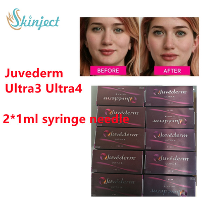 Enchimento cutâneo ácido hialurónico do bordo de Juvederm do enchimento de Juvederm com  2x1ml Ultra3 Ultra4