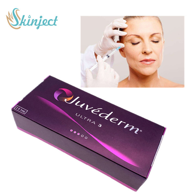 Juvederm injeção cutânea ácida hialurónica do enchimento de ultra 3 enchimentos faciais da injeção