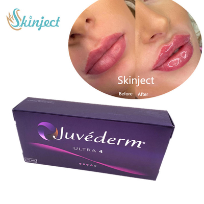 Enchimento cutâneo ácido hialurónico do enchimento dos bordos de Juvederm 2*1ml com Lido Ultra4