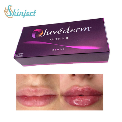 Enchimento ácido hialurónico Juvederm Ultra3 do bordo 281ML cutâneo