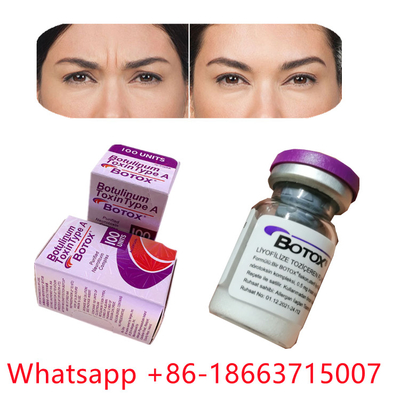 Tipo Botulinum da toxina de Allergan um formulário do pó de