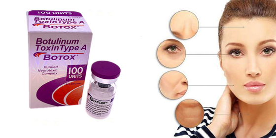 Tipo Botulinum da toxina de Allergan um formulário do pó de