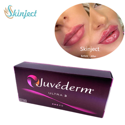 Enchimentos faciais ácidos hialurónicos de Juvederm Ultra3 2x1ml cutâneos