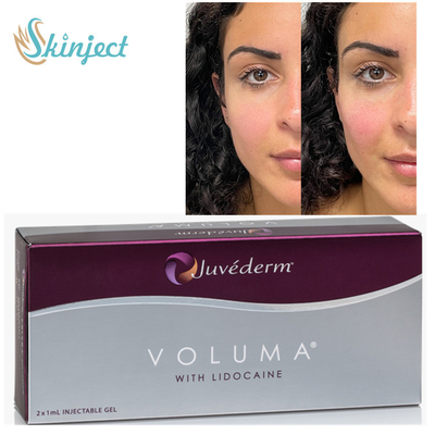 Enchimentos cutâneos de Juvederm Voluma 2x1ml HA para o malar Chin Contouring