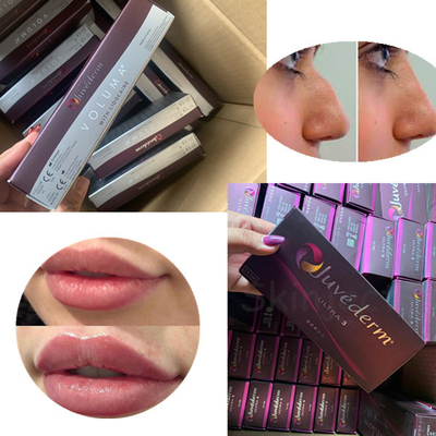 2Ml Juvederm gel médico de Hyaluronate do sódio de ultra 3 volumes para os bordos "sexy"