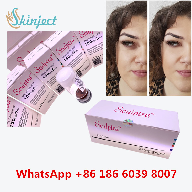 Injeção do Poli-l-lático-ácido PLLA de  para levantar a cara afundado