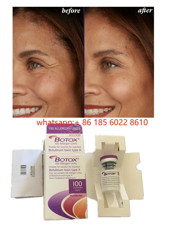 Produtos de beleza Allergan 100unidades Toxina Botulínica  para rugas faciais Preenchimento cutâneo