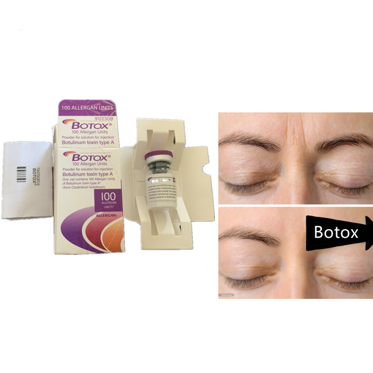 Allergan 100ui Botulinum Toxin Serum Produto Anti-Envelhecimento Para Disportes Faciais