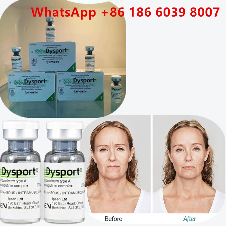 Toxina Botulínica Tipo A 100 Unidades Injecção de  para rugas faciais