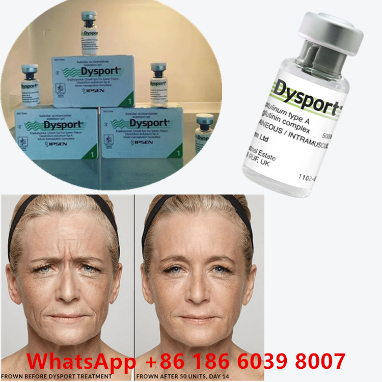 Toxina Botulínica 100 Unidades BTX Injecção Tipo A Utilização cosmética