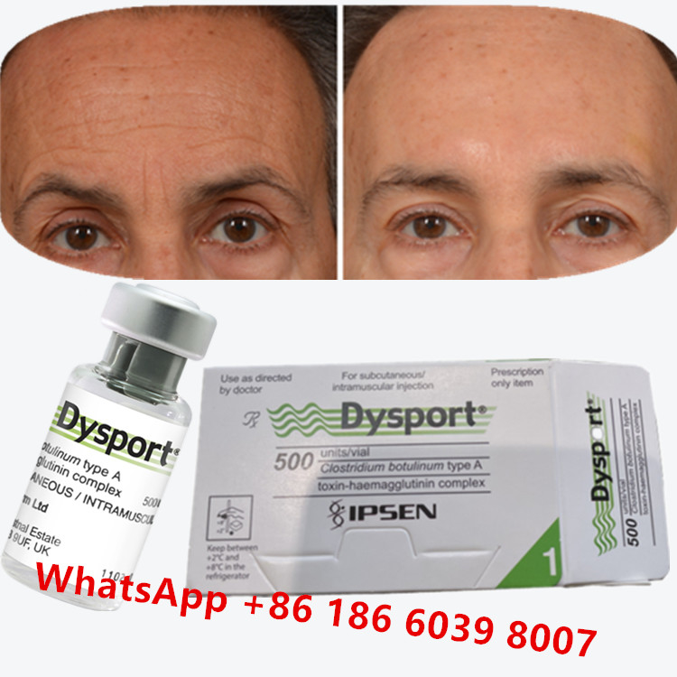 Toxina Botulínica Dysport Clostridium Botulinum Tipo A Para Pés de Corvo