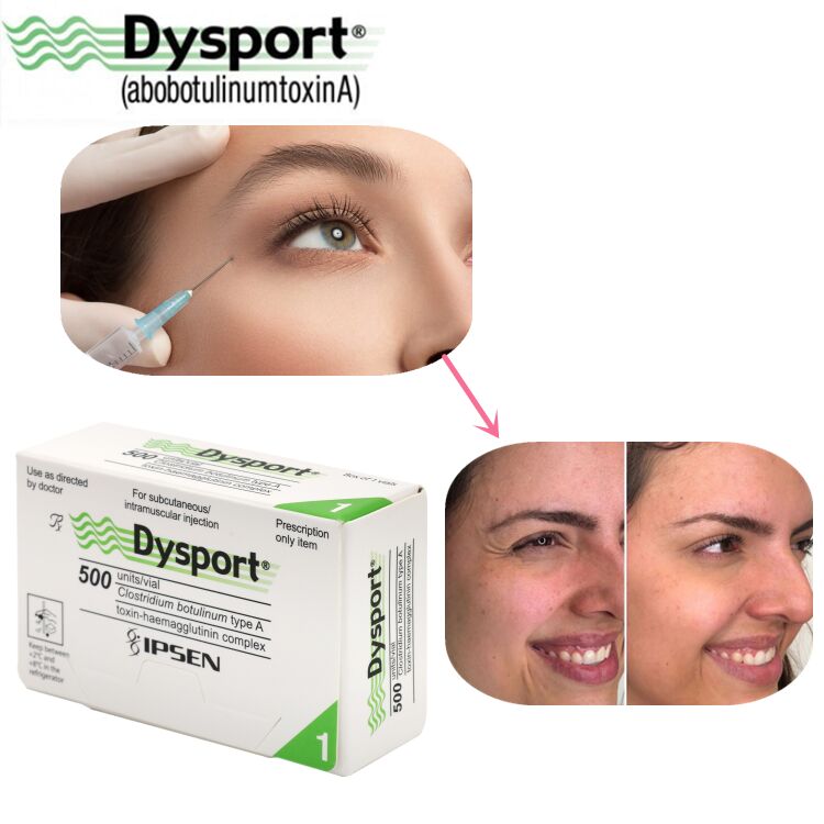 500u Dysport Disparência de rugas faciais Processamento em pó liofilizado Custom OEM Dysport