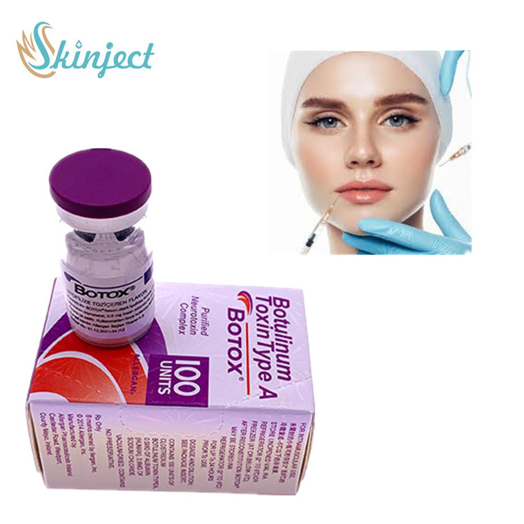 Tipo botulinum da toxina de Allergan 100u uma injeção cutânea do enchimento do