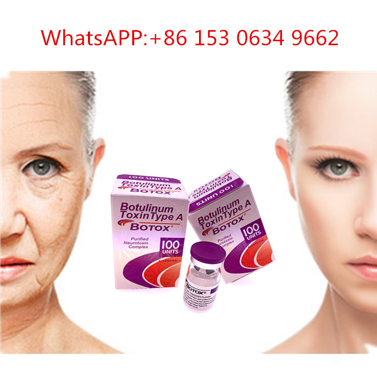 tipo de 50u 100u 150u uma toxina Botulinum da injeção de Allergan  para o anti enrugamento