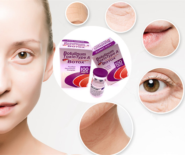 Tipo da toxina de Botuliunm das unidades de Meditoion 50 100 unidades Allergan