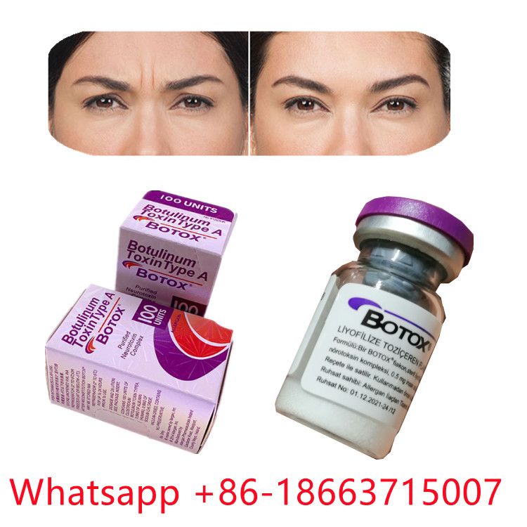 Tipo Botulinum da toxina de Allergan um formulário do pó de
