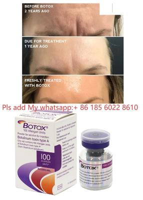 Allergan Botox 100UI Injeção Dysport Toxina Botulínica Botulax Remover Rugas