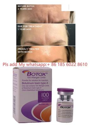 Botox 100UI Allergan Unidades Pó Solução Injeções Toxina Botulínica Botulax Remover Rugas