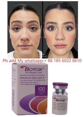Toxina Botulínica Botulax Dysport Allergan Botox para Redução de Rugas e Cosmética