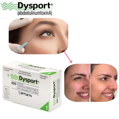 500u Dysport Disparência de rugas faciais Processamento em pó liofilizado Custom OEM Dysport